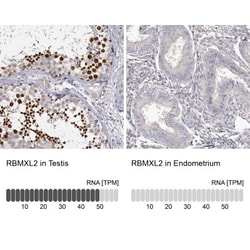 HNRPGT Antibody, Novus Biologicals 25 &mu;L, Unconjugated:Antibodies, Polyclonal